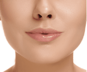 proteger labios del sol